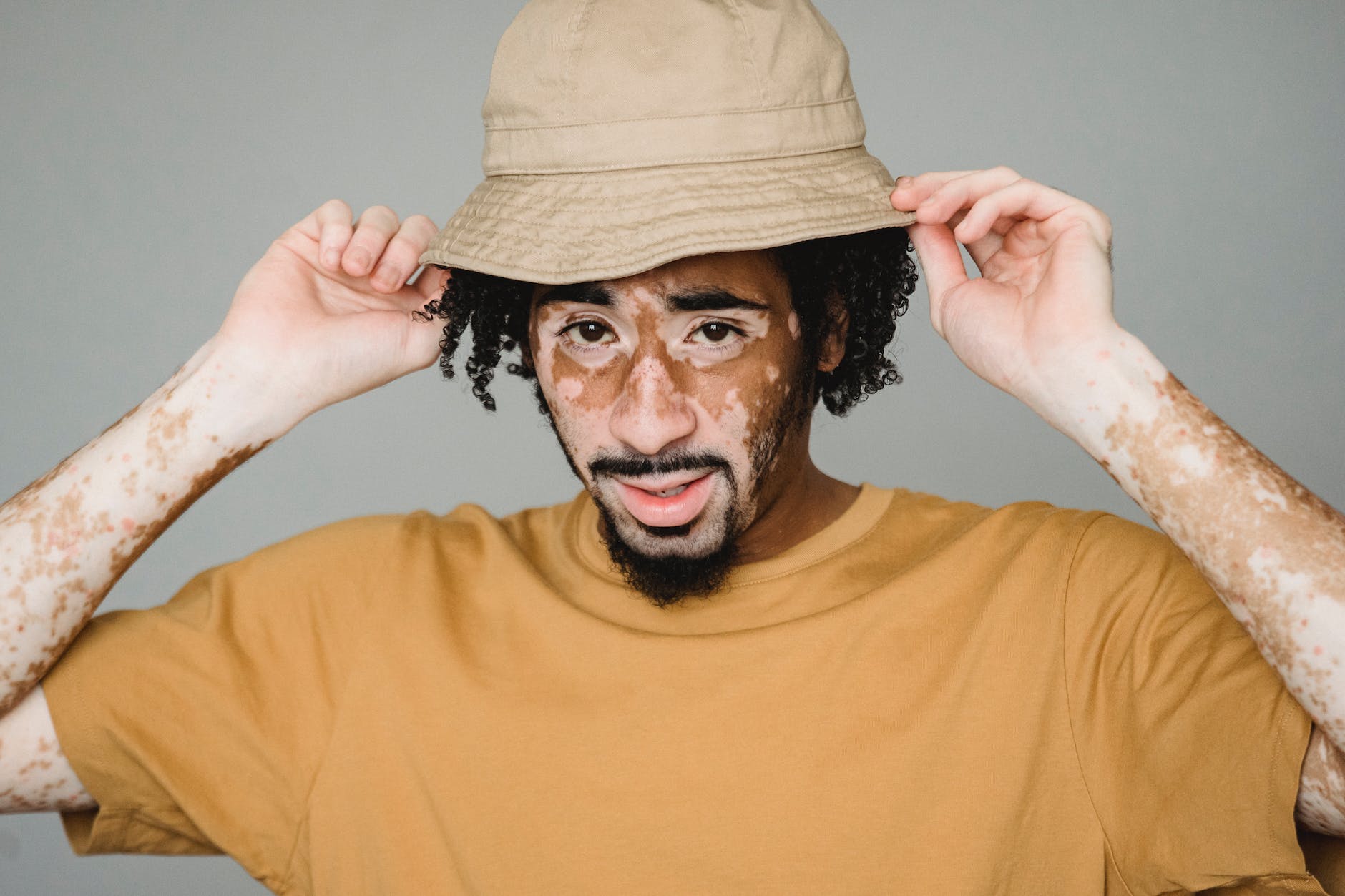 black man with white pigmentation adjusting hat in studio